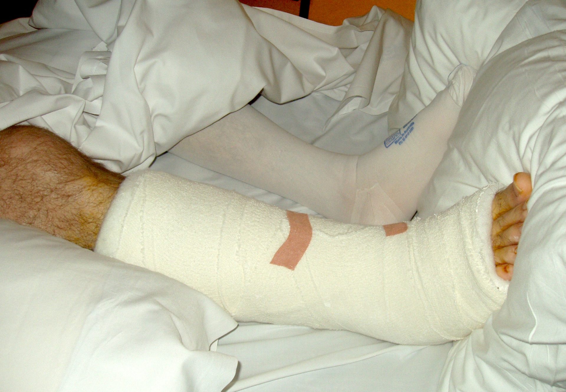 john's broken leg and ankle in bed