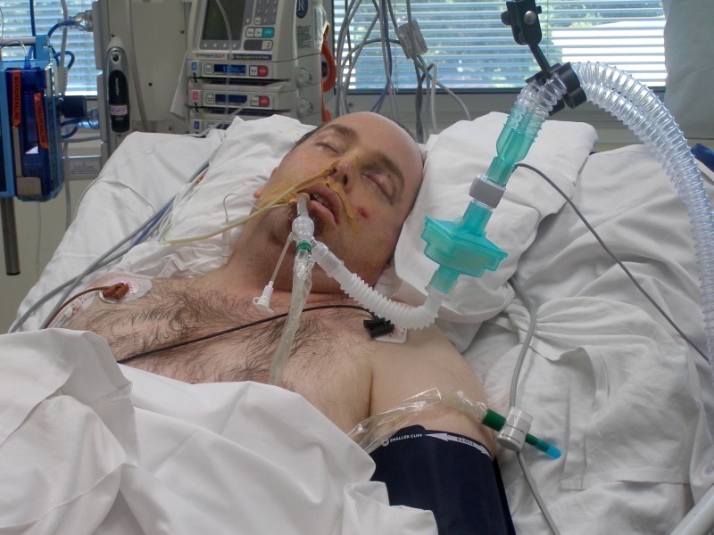john in icu with a spinal cord injury and tubes and wires monitoring his health